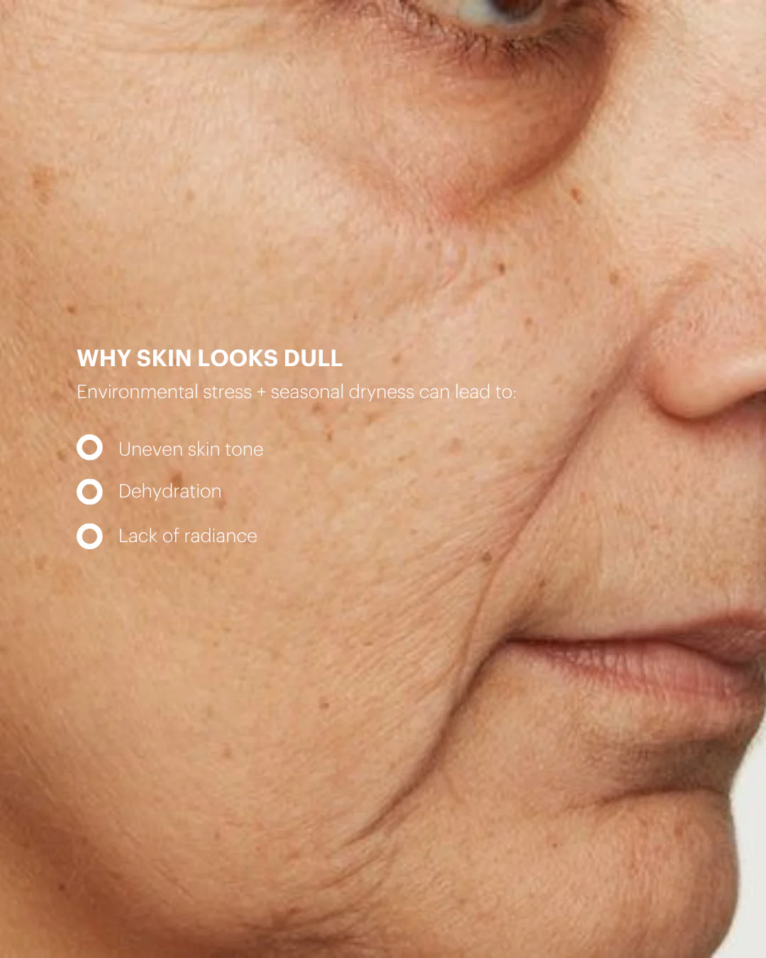 Biolight® Brightening Overnight Cream - Skin Brightening Moisturizer - Image 6
