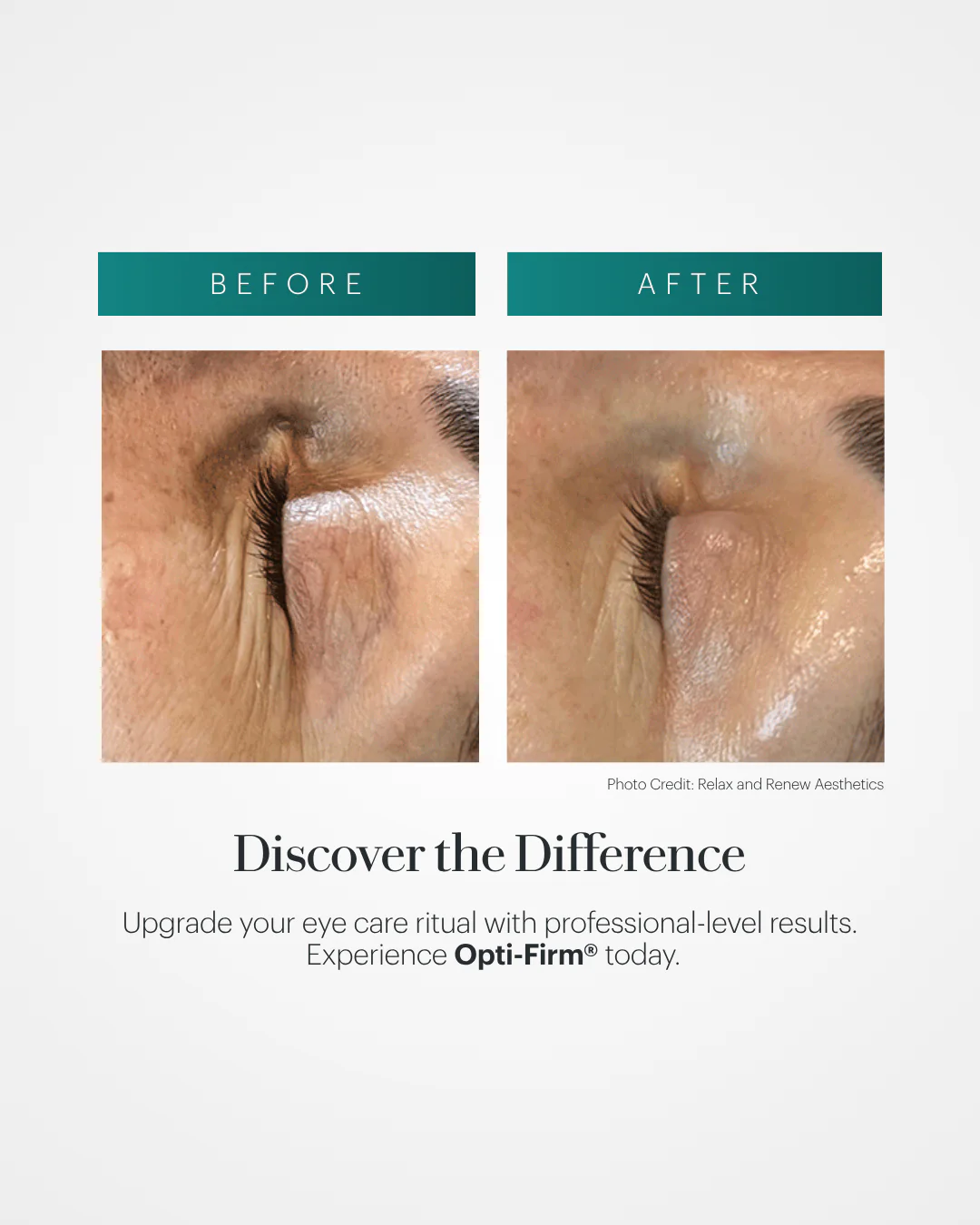 Opti-Firm® Eye Contour Cream - Image 4